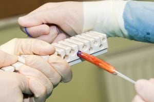 reconstructing the anterior cruciate ligament ACL Reconstruction Harrison NY