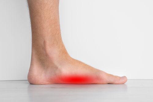 Foot pain because of strong flat feet also called pes planus or fallen arches.